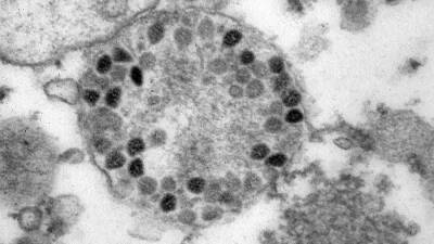 Ученые нашли нейтрализующие «Омикрон» антитела - iz.ru - Израиль