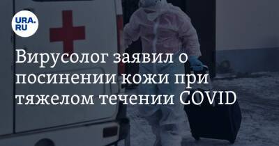 Максим Скулачев - Вирусолог заявил о посинении кожи при тяжелом течении COVID - ura.news