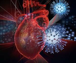 Кардиологи узнали, что почти 60 процентов людей после коронавируса страдают деформацией сердечной мышцы - goodnews.ua - Тюменская обл.