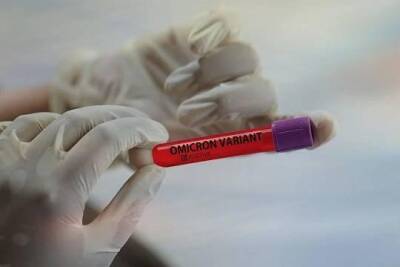 Учёные из ЮАР оценили уровень смертности при омикрон-штамме коронавируса - versia.ru - Юар
