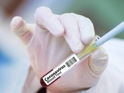 В Японии заявили о резком снижении заболеваемости и «самоликвидации» коронавируса - rosbalt.ru - Япония - Индия