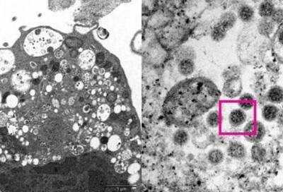 Ученые из Гонконга опубликовали первую фотографию омикрон-штамма коронавируса - online47.ru - Гонконг - Гонконг