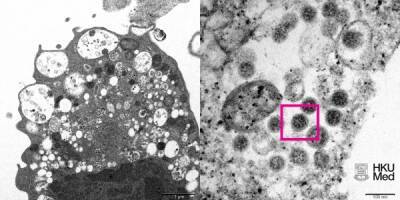 Ученые из Университета Гонконга сделали первую фотографию омикрон-штамма коронавируса - nakanune.ru - Россия - Гонконг - Гонконг - Юар