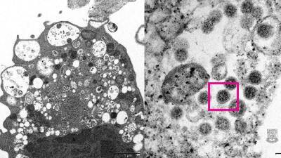 Опубликована микрофотография штамма коронавируса «Омикрон» - iz.ru - Израиль - Гонконг