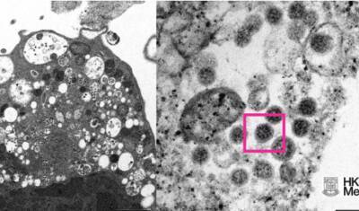 Гонконгские ученые опубликовали первое фото штамма коронавируса «Омикрон» - newizv.ru