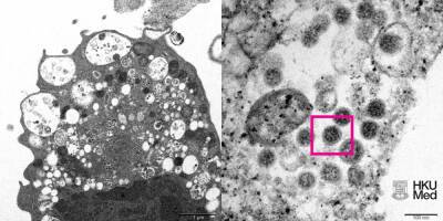 Китайские ученые показали первый снимок штамма коронавируса "омикрон" - news.vse42.ru - Россия