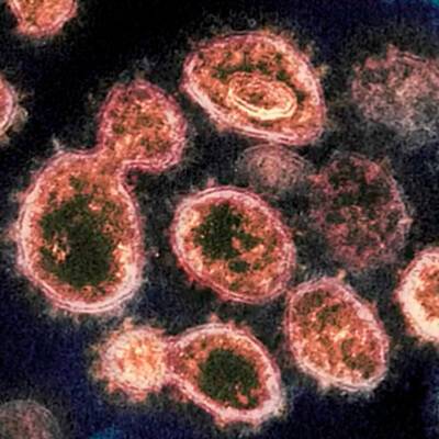 В Австралии выявлена новая разновидность варианта "омикрон"-коронавируса - radiomayak.ru - Австралия - Юар