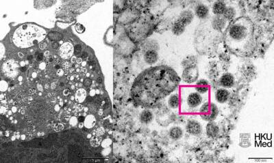 Ученые Гонконга опубликовали изображение омикрон-штамма коронавируса - capital.ua - Украина - Гонконг - Гонконг