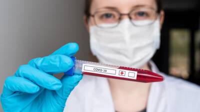 За сутки зафиксировали 12 376 новых случаев коронавируса - ru.slovoidilo.ua - Украина