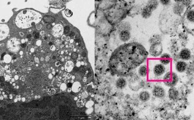 Ученые опубликовали фотографии вируса «Омикрон» - skuke.net - Гонконг - Гонконг - Юар - Ботсвана