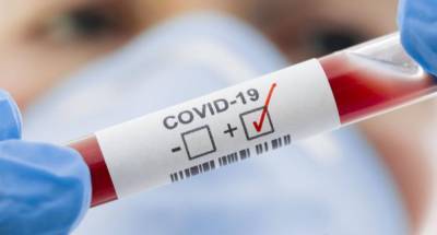 В Украине обнаружено 3409 новых случаев COVID-19: данные по регионам - vchaspik.ua - Украина