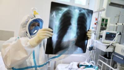 В Москве врачи спасли пациентку с поражением 100% лёгких - russian.rt.com - Москва