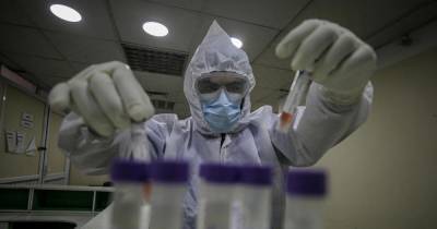 Ученые уже разрабатывают прототипы универсальной вакцины от всех штаммов коронавируса - focus.ua - New York
