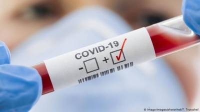 Врачи выявили новый редкий симптом коронавируса - enovosty.com - Египет