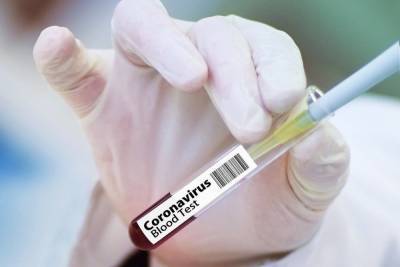 Австрийская газета заявила о «шоке» Европы от российской вакцины - mk.ru - Россия - Сша - Австрия
