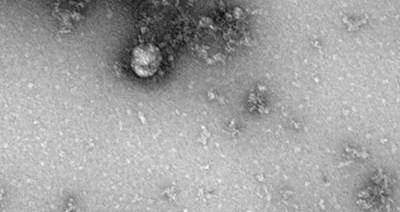 Андрэ Гютер - Ученые назвали реальный цвет коронавируса - m24.ru