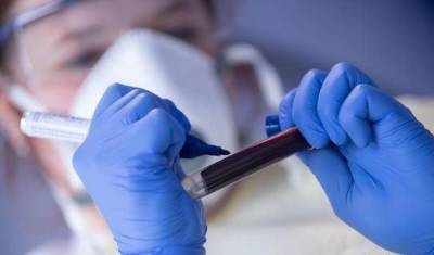 Сергей Собянин - В "Инвитро" доступен тест на поствакцинальный иммунитет к COVID-19 - newizv.ru