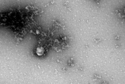 Названа причина высокой заразности нового штамма коронавируса - lenta.ru - Индия - Швеция