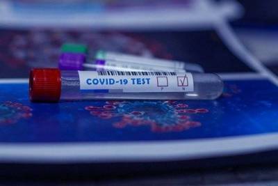 В Европе стали торговать поддельными отрицательными тестами на коронавирус - versia.ru - Франция - Англия - Испания - Голландия - Евросоюз