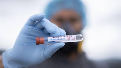 Анна Попова - Россия зарегистрировала тест-систему для выявления "британского" штамма коронавируса - newinform.com - Россия - Финляндия - Англия - Япония - Бразилия - Юар