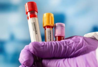 Максим Степанов - В Украине 3206 новых случаев коронавируса - facenews.ua