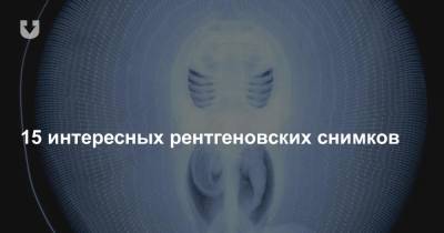 15 интересных рентгеновских снимков - news.tut.by