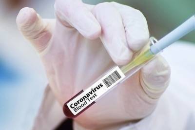 Еще 52 человека заболели коронавирусом в Татарстане - kazan.mk.ru - республика Татарстан