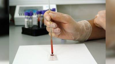 Тяжесть течения коронавируса будут предсказывать по анализу крови - nation-news.ru