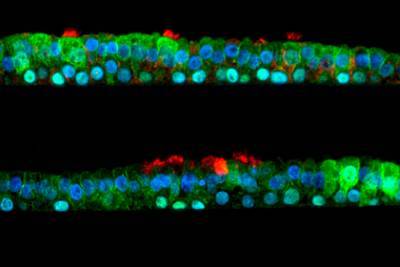 Создан спрей против коронавируса и обычной простуды - lenta.ru