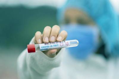 В Украине за минувшие сутки выявили 3285 новых случаев коронавируса, выздоровело - 10 101 пациент - zik.ua