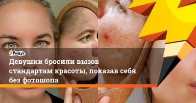 Девушки бросили вызов стандартам красоты, показав себя без фотошопа - ridus.ru