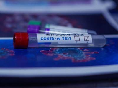 Самый низкий в Украине уровень тестирования на коронавирус зафиксирован в Киевской области - gordonua.com - Киевская обл.