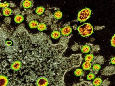 Новый коронавирус с двумя мутациями: насколько он опасен - unn.com.ua - Англия - Киев