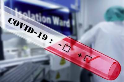 Надир Арбер - Израильский препарат от COVID 96% эффективности проходит стадию испытаний на людях - isroe.co.il - Тель-Авив - Ихилы