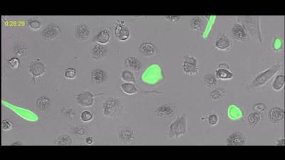 Ученые открыли белок, способный освободить клетки от неактивного ВИЧ - ru.espreso.tv - Вашингтон