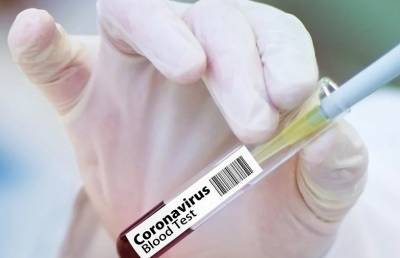 Китай одобрил для широкого применения вакцину собственного производства от COVID-19 - ont.by - Китай