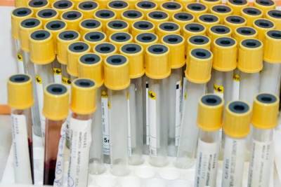 В России выявили менее 16 тысяч новых случаев заражения коронавирусом впервые с октября - argumenti.ru - Россия