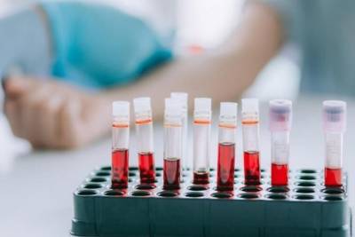 Сергей Лукьянов - Плазму крови для лечения COVID-19 впервые начали заготавливать в Забайкалье - chita.ru - Забайкальский край