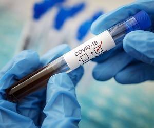 Как и где в Киеве можно сдать тест на коронавирус - goodnews.ua - Киев