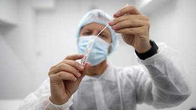 В Роспотребнадзоре создали тест для определения количества коронавируса - iz.ru - Россия - Израиль