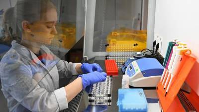 Светлана Яцышина - Роспотребнадзор разработал тест для определения количества коронавируса в биоматериале - runews24.ru