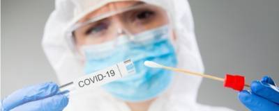 Светлана Яцышина - В Роспотребнадзоре создали первый тест для определения количества коронавируса в биоматериале - runews24.ru - Россия