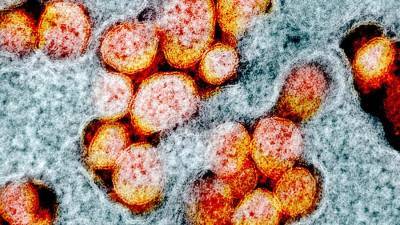 Во Франции нашли плохо поддающийся выявлению штамм коронавируса - iz.ru - Франция - Израиль - Ланьон
