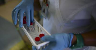 Во Франции обнаружили новый штамм коронавируса: его не фиксируют обычные ПЦР-тесты - tsn.ua - Россия - Франция - Украина