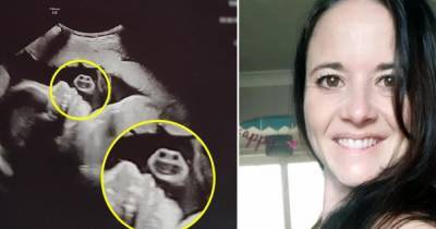 Беременная увидела загадочное "лицо" рядом с ребенком на снимке УЗИ - ren.tv - Англия
