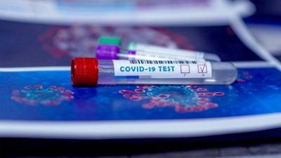 Ученые назвали группу риска повторного заражения коронавирусом - vesti.ru
