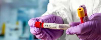 В Оренбургской области обнаружены еще 79 заразившихся коронавирусом - runews24.ru - Оренбургская обл.