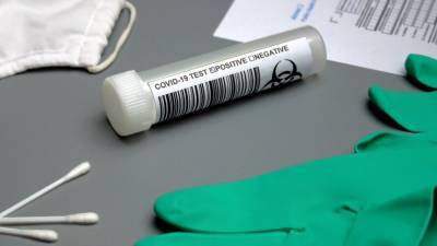 Новый тест на коронавирус позволит определять наличие инфекции по мазку кожи - inforeactor.ru