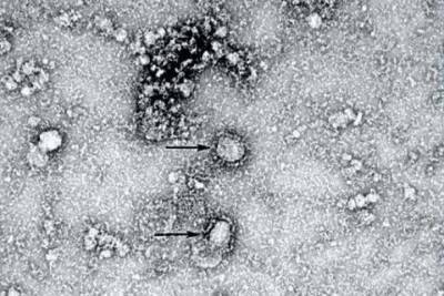 Роберт Редфилд - Американский ученый выдвинул версию происхождения нового коронавируса - vm.ru - Сша - Китай - Ухань