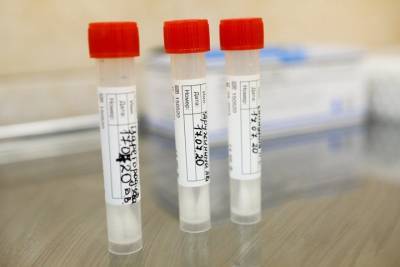 В России зарегистрирован первый ПЦР-тест на малярию - vm.ru - Россия